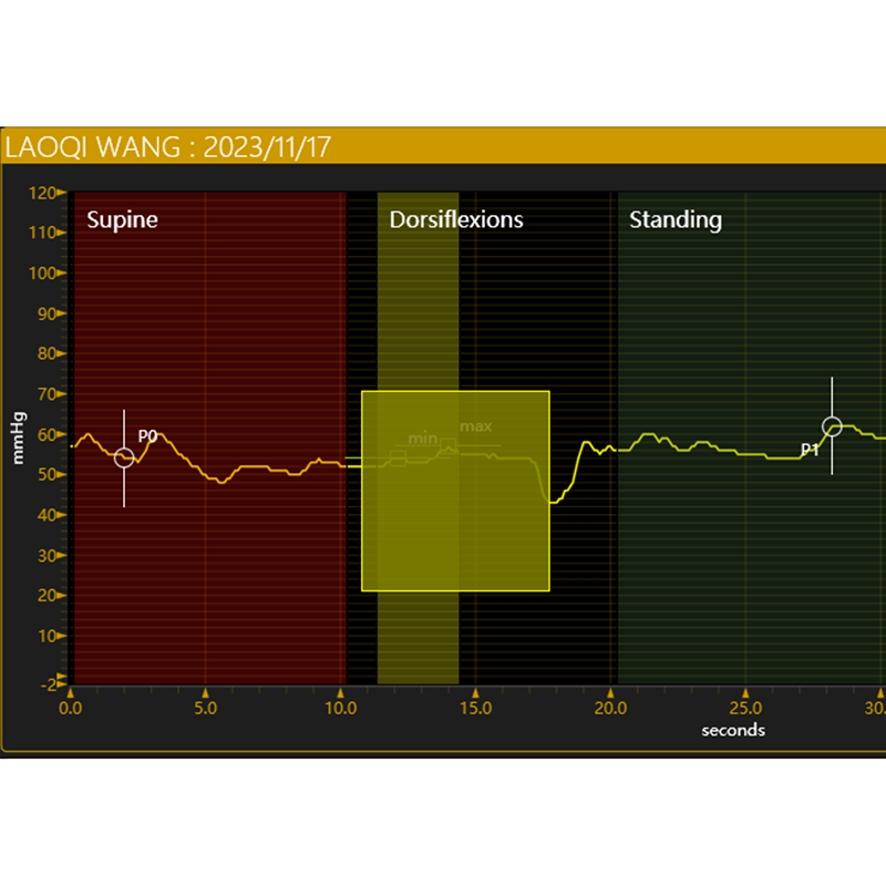 PicoPress動靜態(tài)繃帶皮膚壓力測量系統(tǒng)-動態(tài)硬剛度指數(shù)（Dynamic Stiffness Index，DSI）-靜態(tài)硬剛度指數(shù)（Static Stiffness Index，SSI）、動態(tài)行走壓力振幅（Walking Pressure Amplitude，WPA）-繃帶下皮膚壓力監(jiān)測-繃帶護理培訓(xùn)